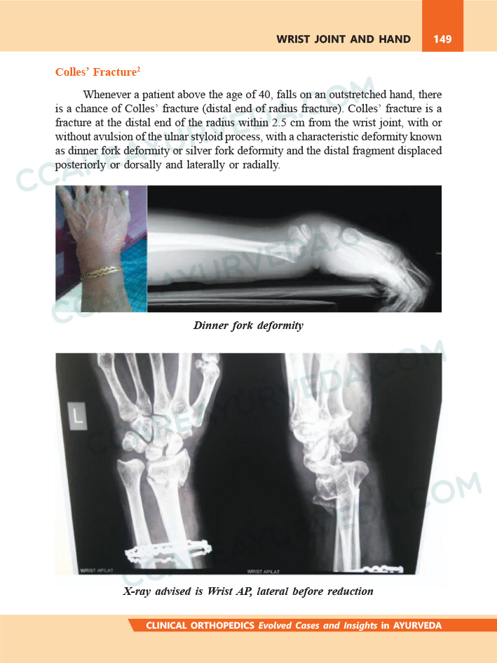 Wrist Joint and Hand - Clinical Orthopedics Book Page